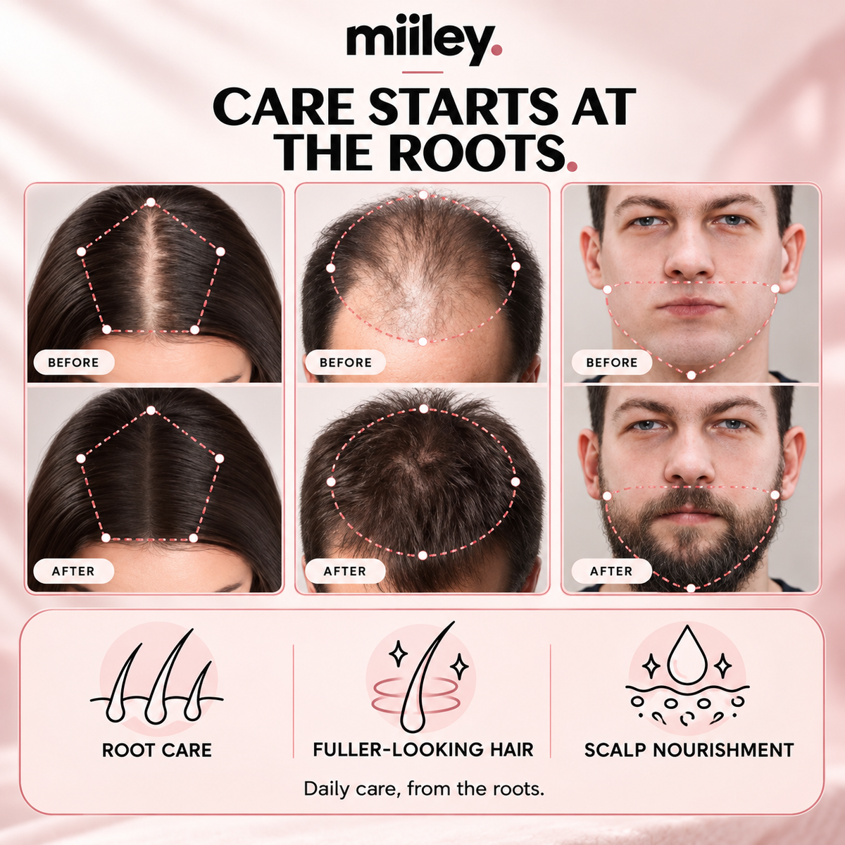 Care starts at the roots