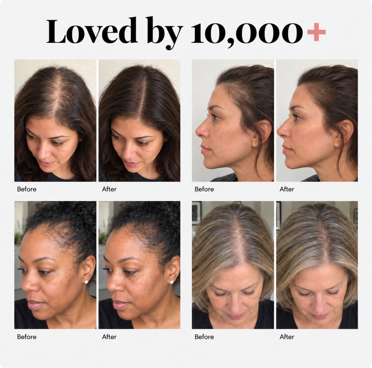 Red Light Scalp Massage Comb
